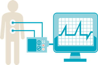 取消“一品双规”，国产高端医疗器械打破外资垄断的技术转让路径